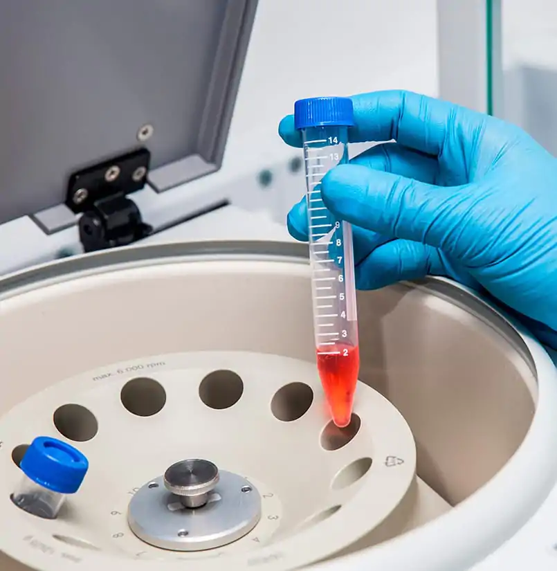 Mão com luva médica segurando tubo em cima de aparelho