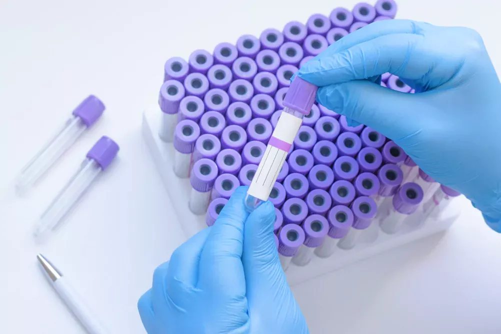 Exames indicados na menopausa